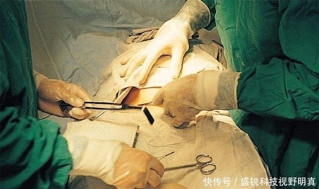 手术|有些人为什么剖腹产手术,开刀只需5分钟,但缝合要1个小时呢?