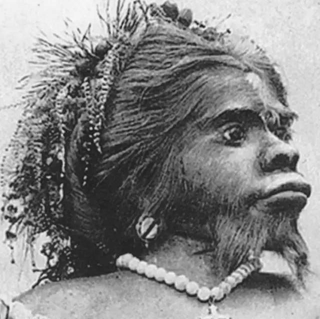 出生|史上最丑的女人,生前轰动一时,死后被丈夫制成标本展览154年