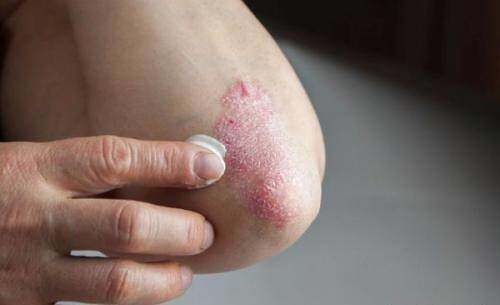 养肝护肝|肝脏也喜欢“吃水果”?医生提示:3种水果有益肝脏,可适量多吃