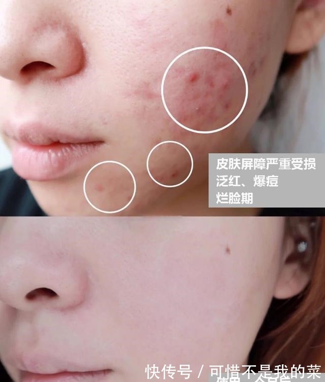 保湿|面霜不一定非要买贵的,3款口碑不错的经典国货,款款好用价不高!