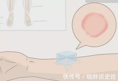 抗组胺药|宝宝得荨麻疹总是想挠怎么办？这个治疗办法百试不爽！