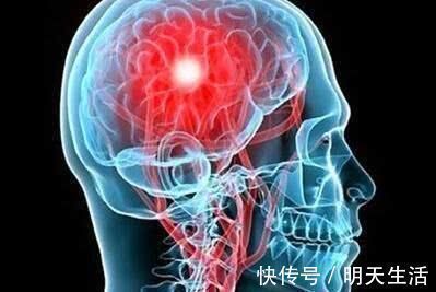 老年痴呆|失眠是长寿路上的“绊脚石”,简单四招,助你沾床就睡,比猪香甜