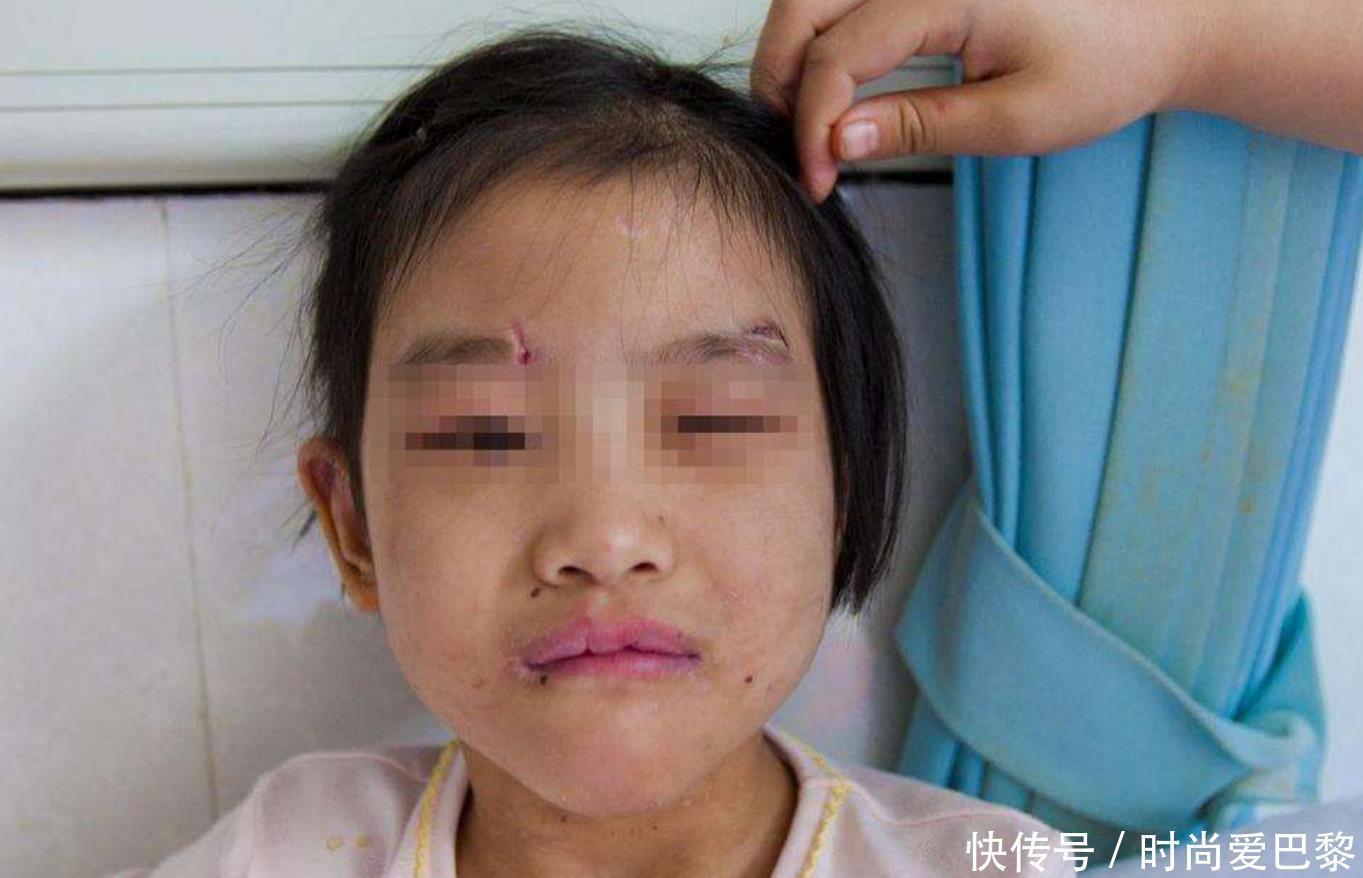 太阳穴|打孩子要有度,这4个部位是孩子的“生命线”,父母再生气也别打