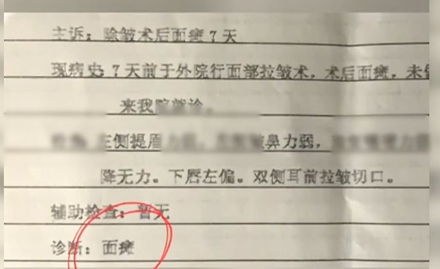 拉皮 女子花1万块让朋友在家做拉皮手术后被诊断为面瘫，朋友曾非法行医被逮捕