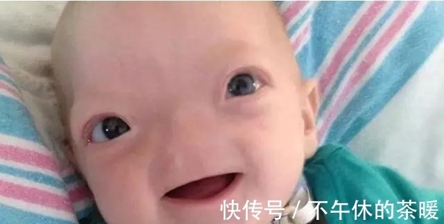 一生|小男孩天生无鼻,却坚持走完了一生