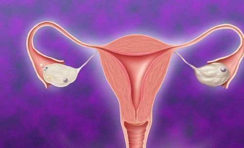 手术|子宫肌瘤一定要做手术吗？有3种情况可以不用做手术