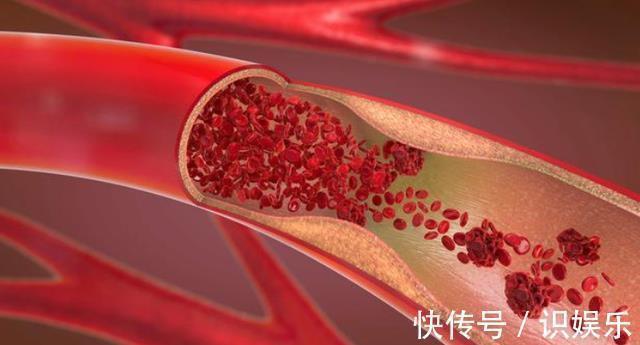 心脑血管|吃羊肉,对人体的心脑血管好吗医生给出答案