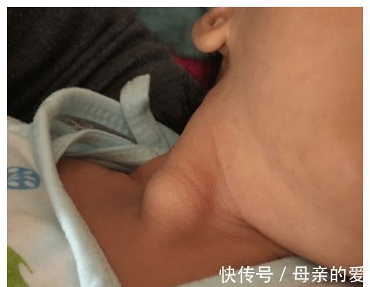脖子|宝宝经常歪脖子危害大？原来是这几个原因，3招教你轻松解决
