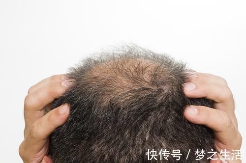 胆红素|头部有3个异常，暗示肝硬化，肝病最怕拖，出现一个也要尽早检查