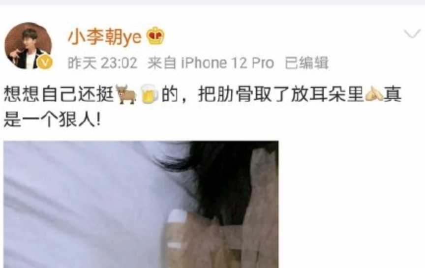 猴相|好奇葩……