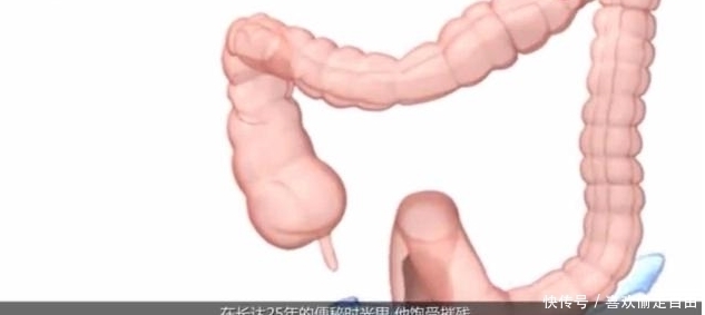 男子三年没上厕所,成为史上第一个被憋死的人!