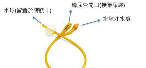 导尿管居家护理正确打开方式 导管应如何选择 为家人学习 快资讯