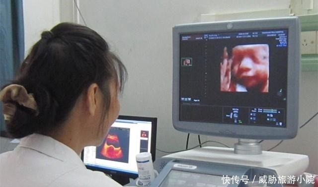 医生|怀孕8个月查出畸形,医生建议引产,孕妈纠结到底该留还是“流”