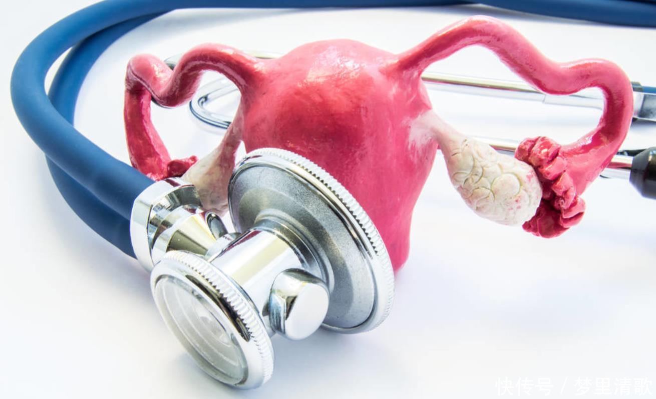 性生活|子宫肌瘤是怎么回事5类女性易患子宫肌瘤