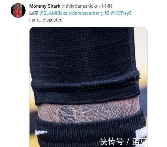 篮网|破案,杜兰特为何因小腿皮肤和球迷互骂网红嫌弃他的原因找到了!