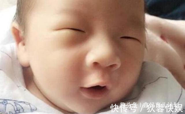 育儿|孩子出生后发现“没眼睛”,爸妈着急送医,医生看后忍不住想笑
