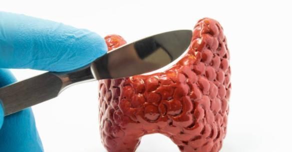 刘女士|颈部突然有三个表现,预示着癌症要来,不要存在侥幸心理!