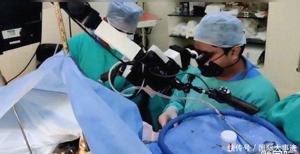 手术|9岁女孩做清醒开颅手术,一边手术,一边玩游戏和弹钢琴6个小时