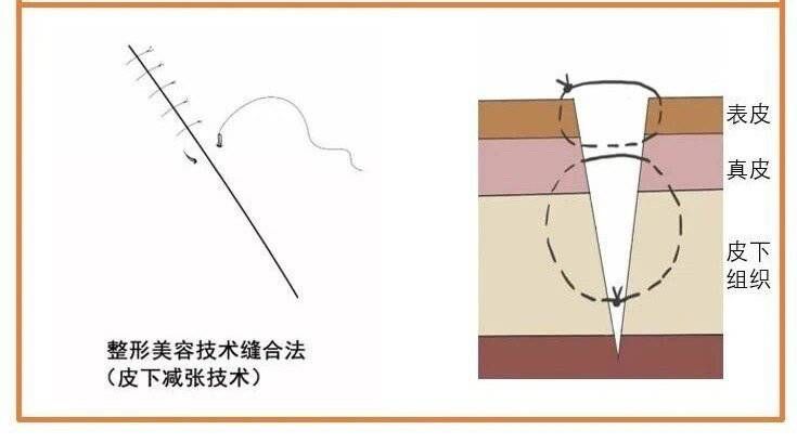 八大处 外伤缝合不想“留疤”？成都有了24小时“美容缝合急诊”！