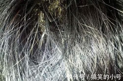头发|如何做能让白发来得晚一些?除了遗传,有3点我们是可以控制的