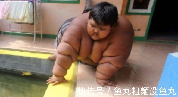 医生|男孩重达400多斤,医生检查后只能活到15岁,怒斥父母无知