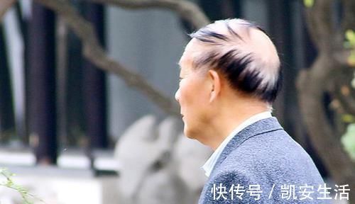 衰老|人到多少岁算老年人世卫组织给出了标准,别不承认了