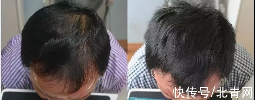 程序员|“我去女友家，被叫伯伯！”杭州90后小伙：这个烦恼实在尴尬