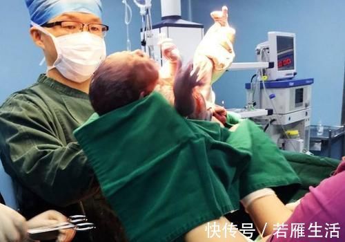 医生|生孩子总遇到男医生？产妇别觉得尴尬，对自己和宝宝有好处