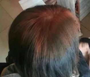 人生第一次|千万不要自己在家染发别怪没提醒你,否则后悔都来不及了