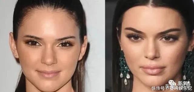 半个娱乐圈女明星脸上都有的这个坑，真的是线雕的锅吗？