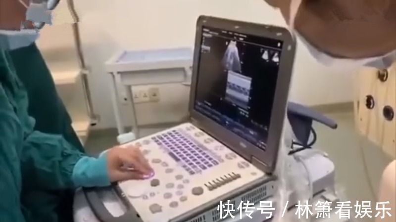 胎位|堪称魔术!1分钟剖宫产变顺产,医院产房上演胎位“乾坤大挪移”