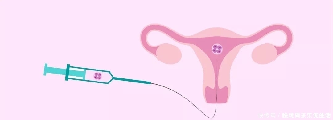 子宫|35岁孕妇22周四维却发现子宫没有胎儿，孩子哪去了呢