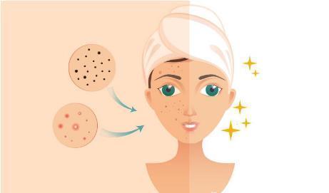 祛除痘印的四个方法安利给你们