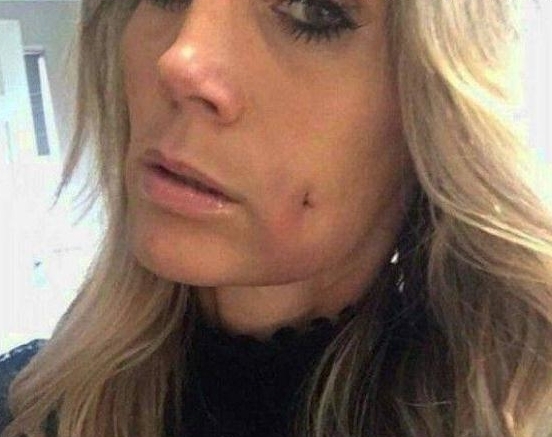 英国女子去美容院做了个酒窝,从那以后却不敢轻易笑