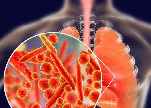 事儿|自费疫苗一针好几百,要不要打?医生:这不是钱的事儿!