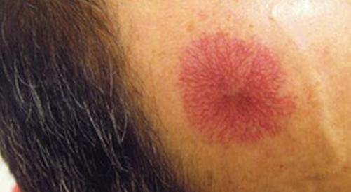 肝病|黄豆是肝病的发物,医生提醒,想要肝脏好,3种食物劝你少吃