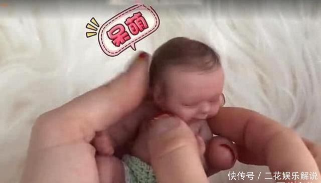 准妈妈|世界最小的婴儿已经14岁了,如今的现状,生活得有滋有味