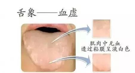  果你|免疫力是长寿关键，到底该如何加强自己免疫力？你的舌头知道答案