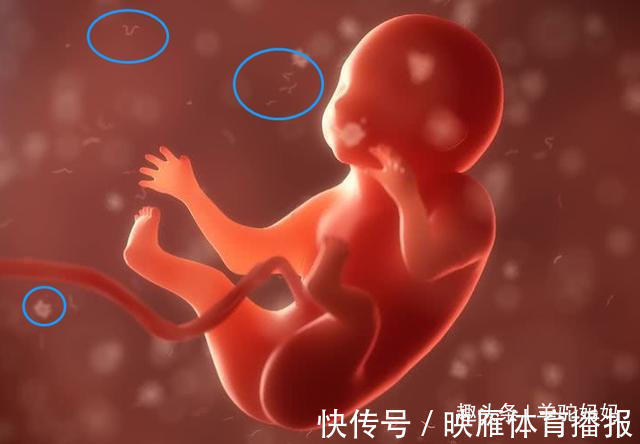 怀孕期间|33岁产妇分娩时突然咳嗽,5分钟后永远闭上了眼,这事孕妈别大意