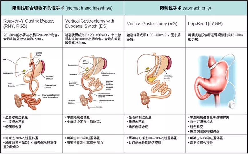 季峰|切胃减重80斤，29岁姑娘却遭遇术后并发症！专家痛心呼吁：科学减肥，安全第一