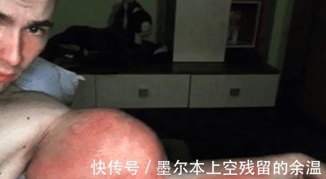 男子|男子在健身房健身时,因为用力过猛感觉不对,抬头观察,手臂爆啦