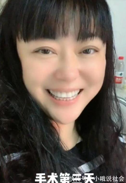 非常6+1|51岁李菁菁回顾抗癌经历,花式鼓励病友,与30岁三婚老公秀恩爱