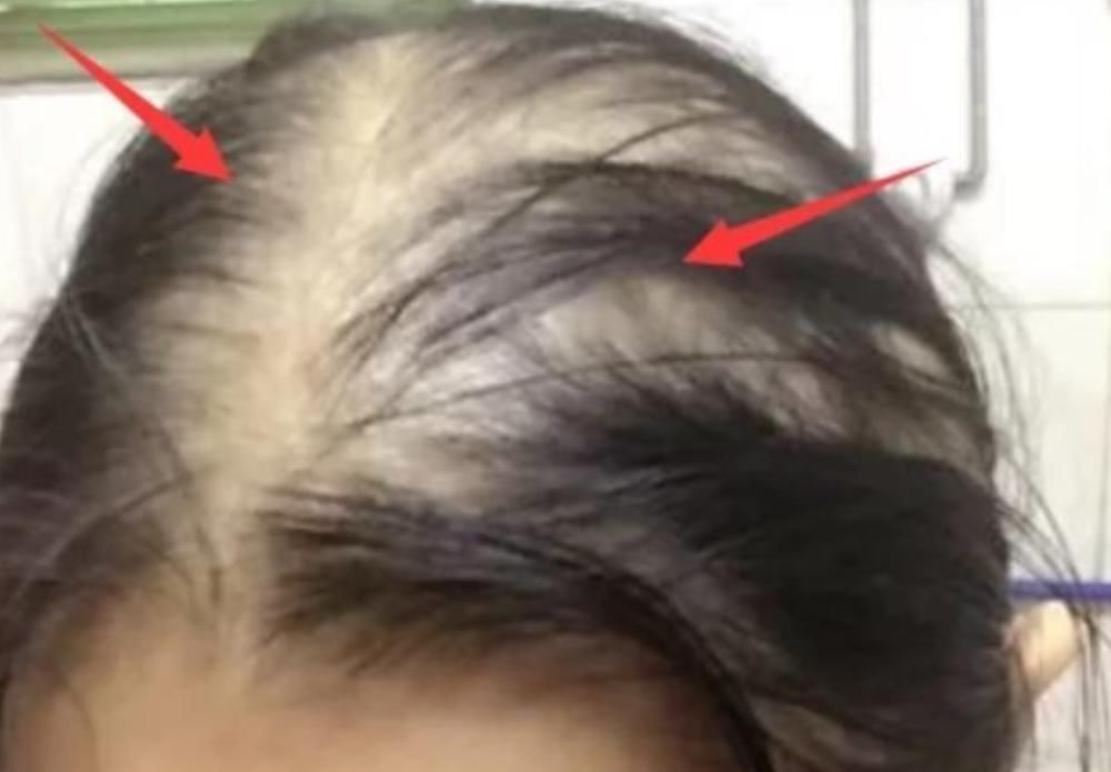 被列入“黑名单”的洗发水,00后女生还在用难怪头发“大把掉”