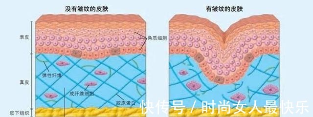 胶原蛋白 你知道哪些医美项目适合自己吗!