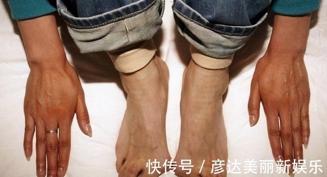 为国争光|她是为国争光的冠军，因训练不科学导致残疾，靠卖奖牌维持生活