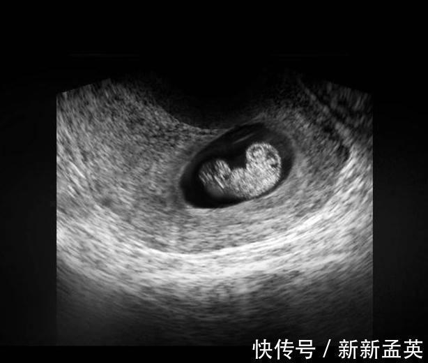 胚胎|胎儿从卵泡到性别形成,17张图片清晰诠释,男宝女宝看得很清楚