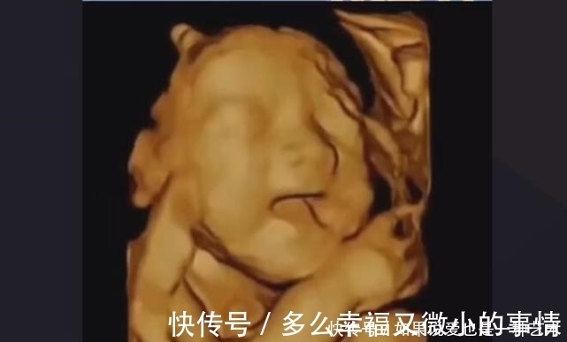 孕晚期|怀孕晚期,如何判断“要生了”?3个方法要牢记,别把孩子生家里