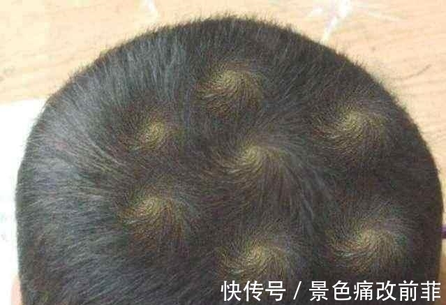 后半句!俗话说“双顶男孩找不到,双顶女孩没人要”,是何意?还受用吗?