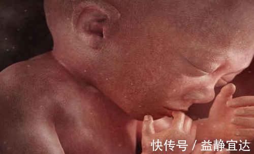 高峰期|胎儿畸形最喜欢出现在这个月份,孕妈只要熬过去就轻松了