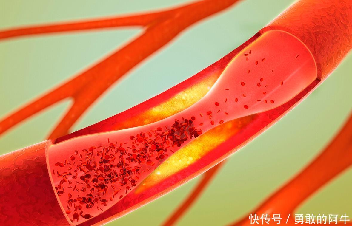 103岁老人,年轻像70岁,长寿秘诀不是多走路,而